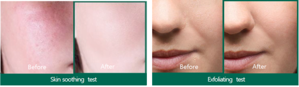 Some By Mi - AHA-BHA-PHA 30 days Miracle Serum - 50ml – Image 2